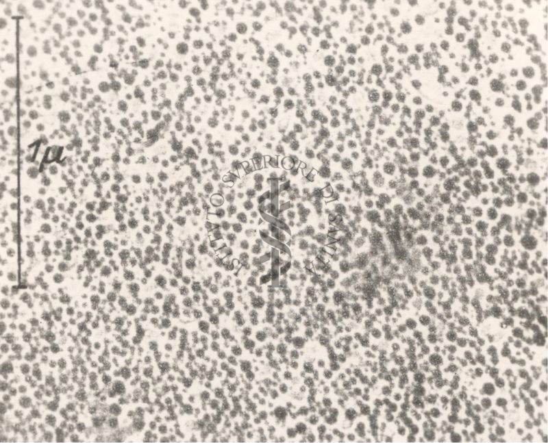 Batteriofagi (microscopio elettronico)