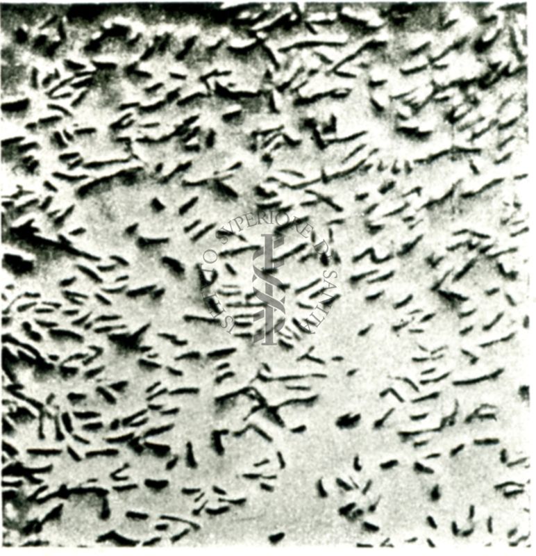 Virus del colera (ingrandimenti successivi) microscopio elettronico