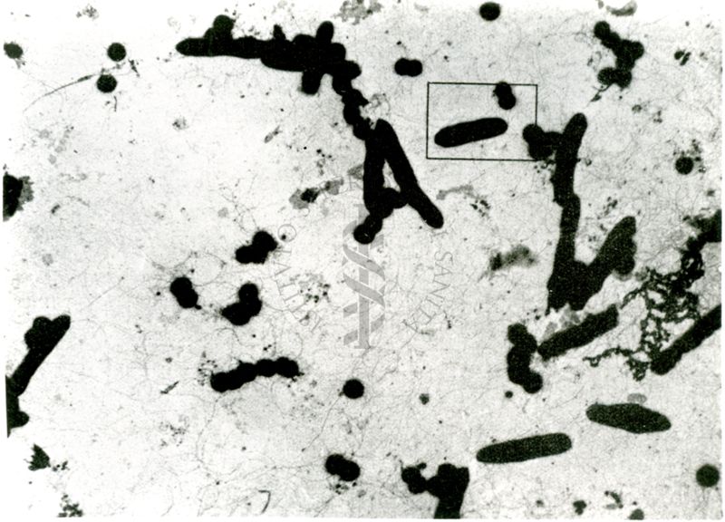 Ingrandimenti successivi di bacilli tetanomorfi (microscopio elettronico)