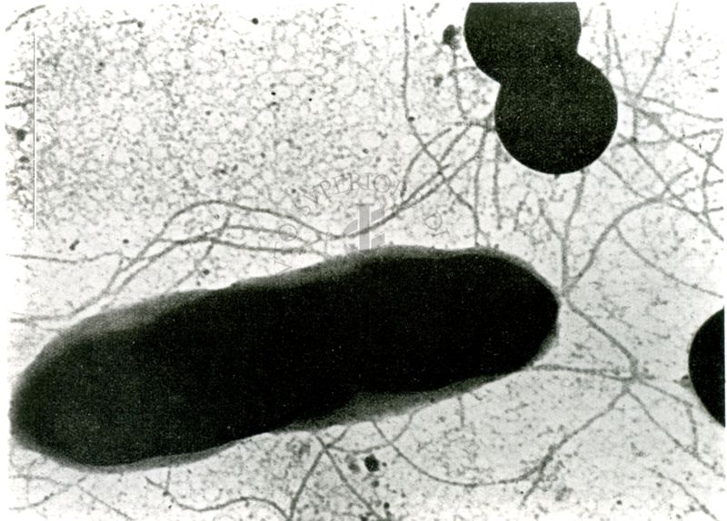 Ingrandimenti successivi di bacilli tetanomorfi (microscopio elettronico)