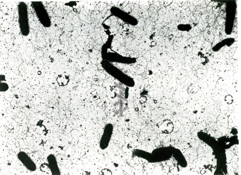 Ingrandimenti successivi di bacilli ciliati (microscopio elettronico)