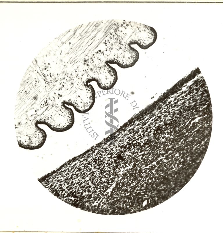 Sarcoma da Cystiarcus fasciolaris