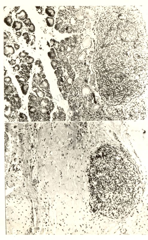 Irradiazione della tiroide del ratto con I 131 integrità perfetta della paratiroide