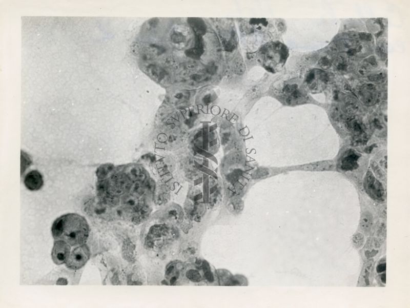 Cellule Hela con virus A.P.C. tipo II°