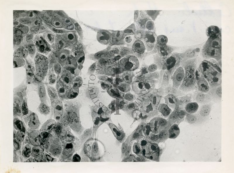 Cellule Hela con virus A.P.C. tipo II°