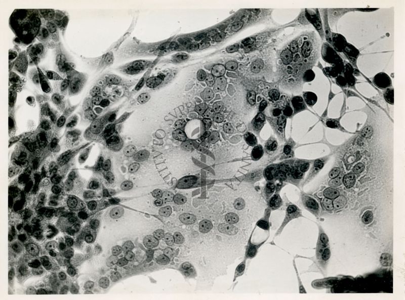 Cellule del rene di scimmia infettate con virus Tardani - Col. E.E.