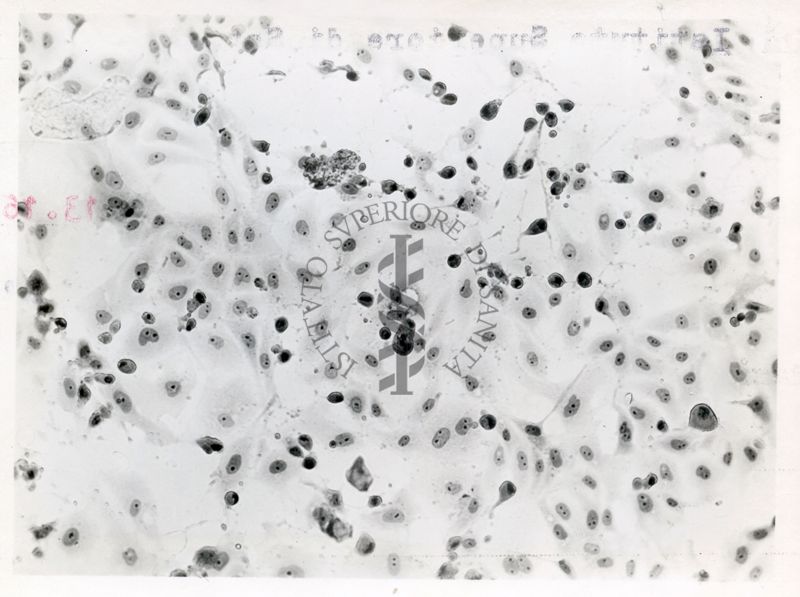 Cellule del rene di una scimmia infettate con virus ECHO di tipo 4 - Col. E.E.