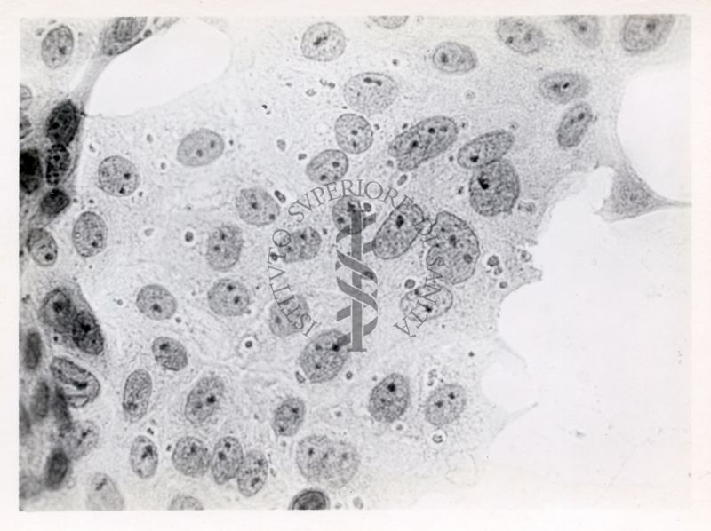 Cellule del rene di una scimmia infettate con virus del vaccino - Col. E.E.