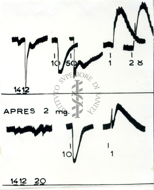 Tracciati grafici degli effetti sulla pressione del cane dei derivati anti nicotinici "Di Parcol". Antagonismo con l'acetilcolina e l'adrenalina