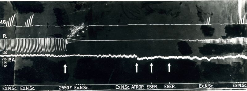 Tracciato dell'azione curarizzante del trioduro del tri (trietilammonioetossi) 1,2,3 benzen (2559 F.). Effetto sulla trasmissione neuromuscolare, i movimenti respiratori e la pressione arteriosa del cane