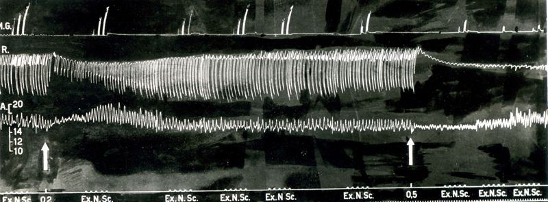 Tracciato dell'Azione curarizzante del trioduro del tri (trietilammonioetossi) 1,2,3 benzen (2559 F.). Effetto sulla trasmissione neuromuscolare, i movimenti respiratori e la pressione arteriosa del cane