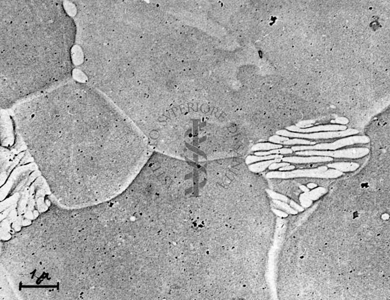 Osservazioni al microscopio elettronico a trasmissione della replica della superficie di un metallo. La deposizione ad un angolo di 45° di atomi pesanti produce la cosiddetta "ombratura" che mette in risalto le strutture di superficie ed offre una immagine in rilievo.