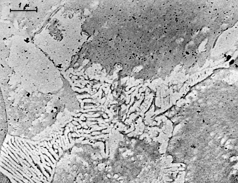 Osservazioni al microscopio elettronico a trasmissione della replica della superficie di un metallo. La deposizione ad un angolo di 45° di atomi pesanti produce la cosiddetta "ombratura" che mette in risalto le strutture di superficie ed offre una immagine in rilievo.