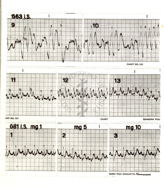 Cardiogrammi dei solfoni cardiotonici