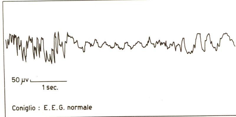 Elettroencefalogramma normale del coniglio
