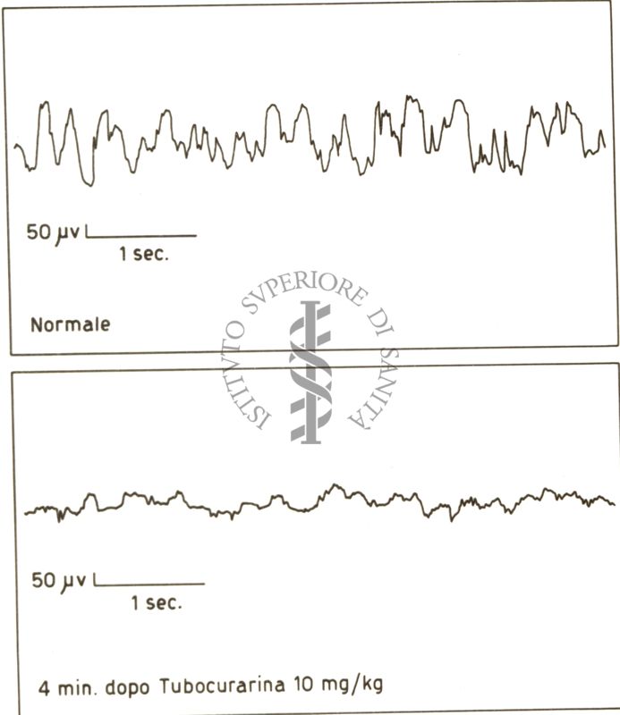 Elettroencefalogramma normale del coniglio