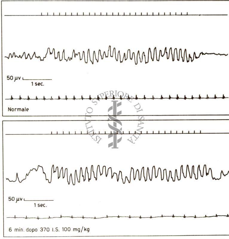 Risposta dell'elettroencefalogramma di coniglio alla stimolazione luminosa prima e dopo il 370 I.S.