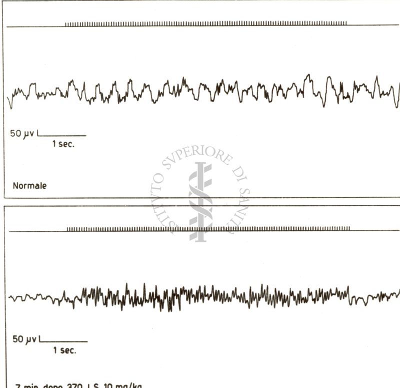 Elettroencefalogramma di coniglio prima e dopo il 370 I.S.