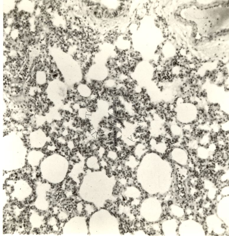 Stimolazione dei macrofagi del polmone durante la reazione di allarme del ratto