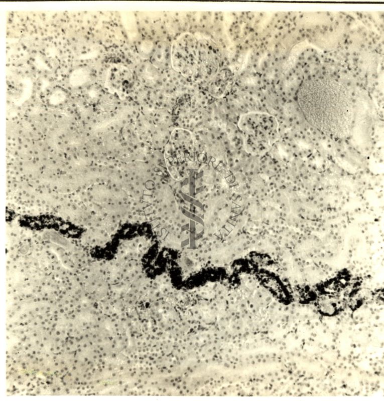 Deposizione di pigmento in un nefrone di ratto dopo trattamento con corticoidi