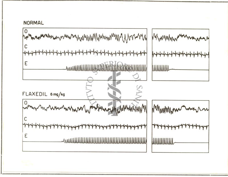 Azione del Flaxedil sull'elettroencefalogramma del coniglio prima e dopo curarizzazione