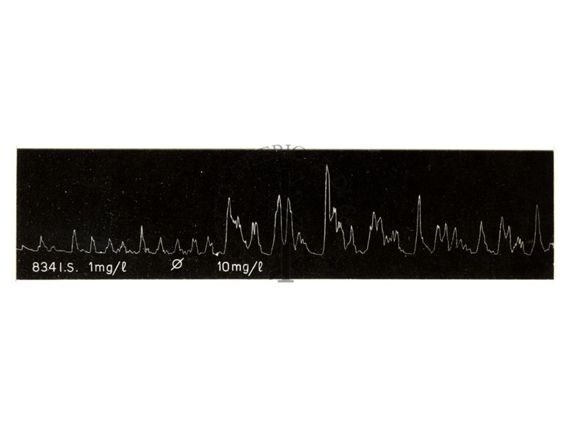 Immagine dell'azione oxitocica su uteri isolati di coniglio e di cavia di alcuni ergotamminici di sintesi