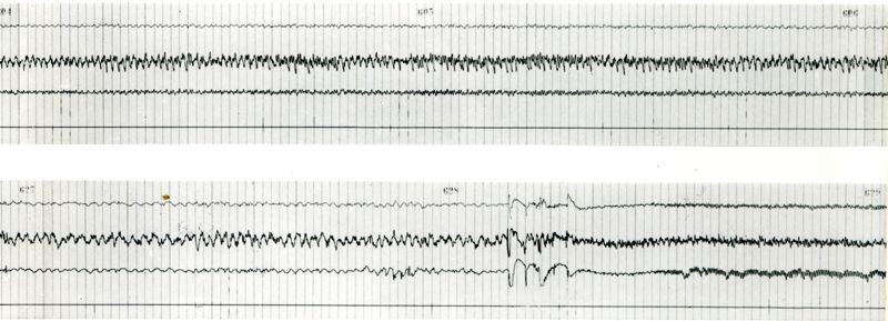 Tracciati elettroncefalografici di coniglio