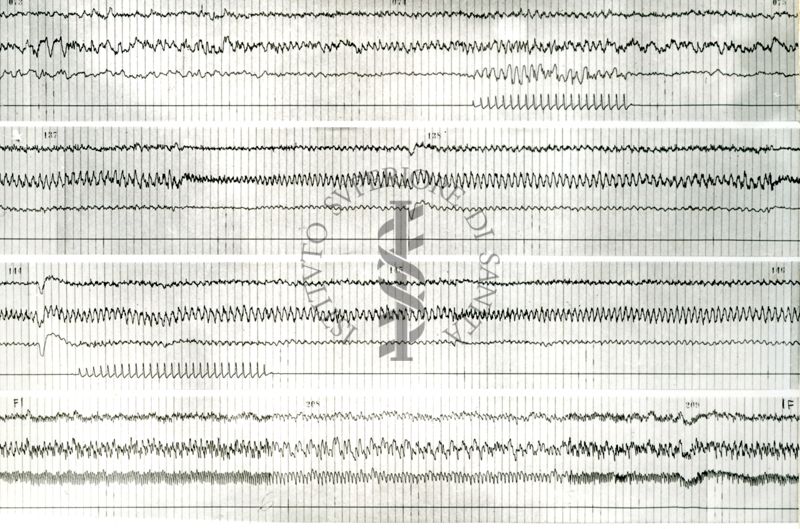 Tracciati elettroncefalografici di coniglio