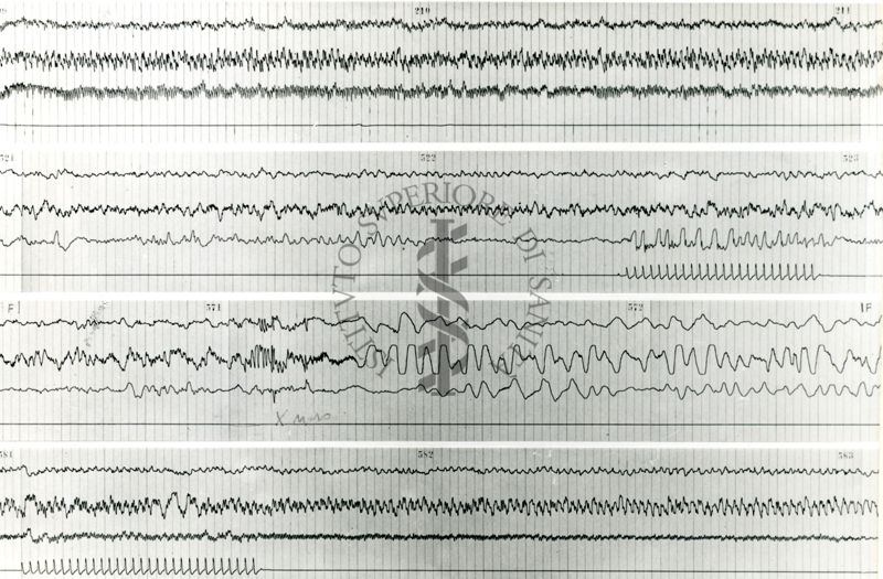 Tracciati elettroncefalografici di coniglio