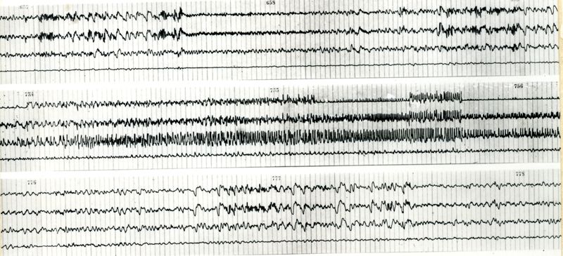 Tracciati elettroncefalografici di coniglio