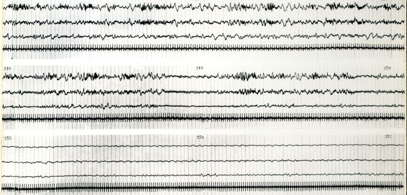 Tracciati elettroncefalografici di coniglio