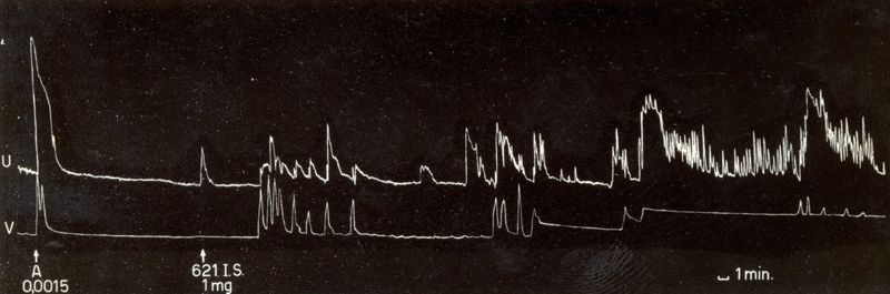 Grafico indicante l'azione oxitocica di alcuni derivati di sintesi della tetra idro naftil ammina su uteri isolati di coniglio e di cavia