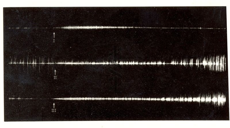 Grafico riguardante l'azione iperemizzante di Etil - Thn