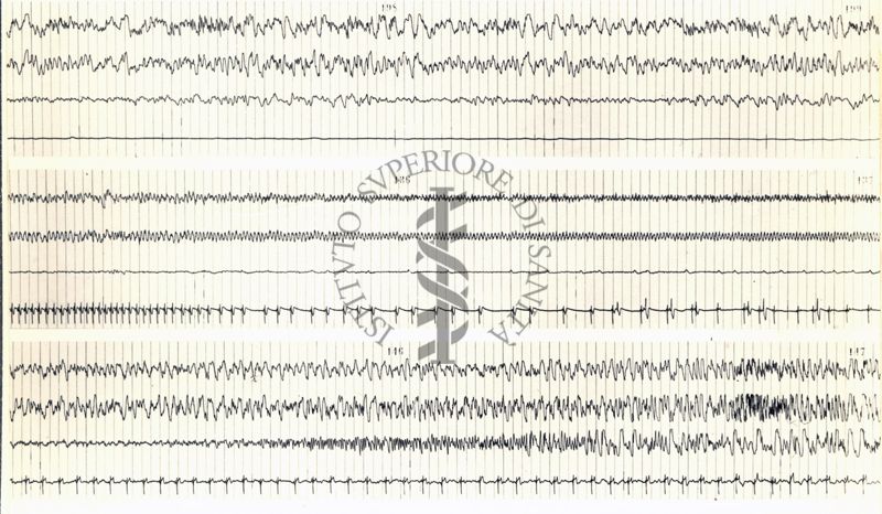 Tracciati elettroencefalografici di coniglio