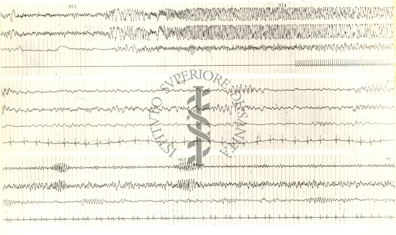 Tracciati elettroencefalografici di coniglio