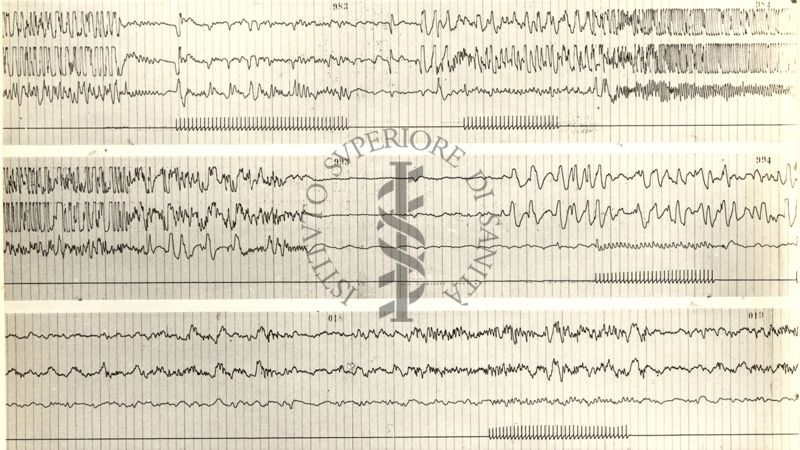 Tracciati elettroencefalografici di coniglio