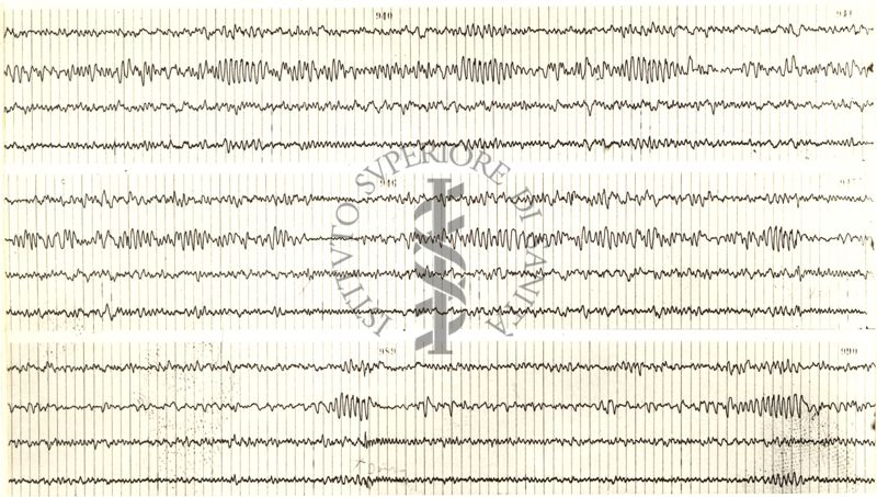 Tracciati elettroencefalografici di coniglio