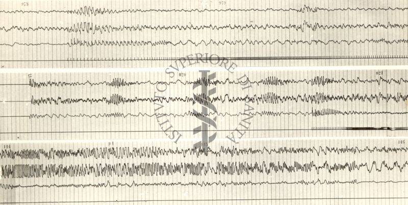 Tracciati elettroencefalografici di coniglio