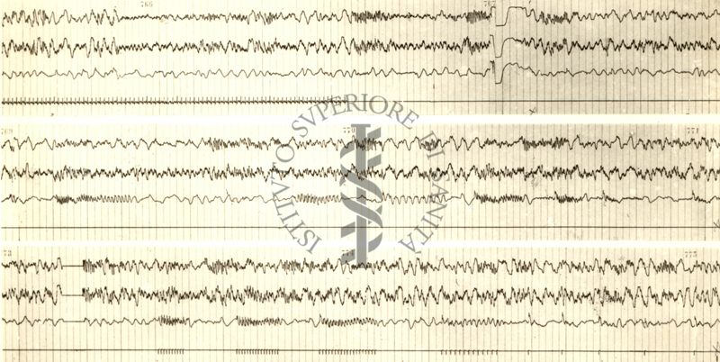 Tracciati elettroencefalografici di coniglio