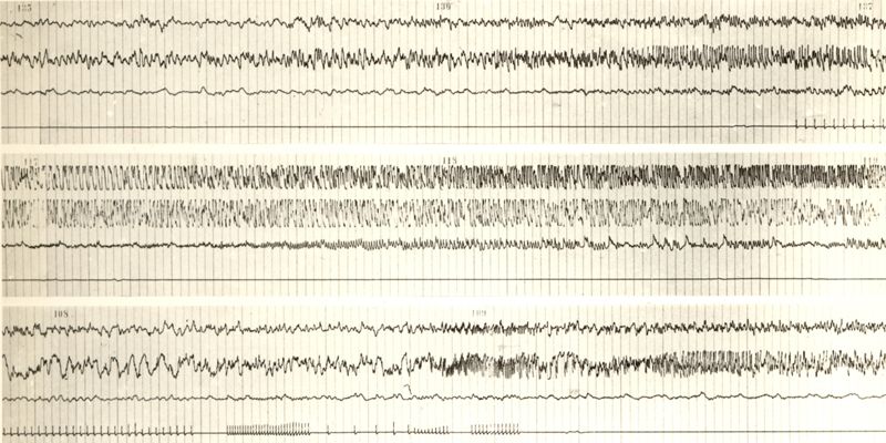 Tracciati elettroencefalografici di coniglio