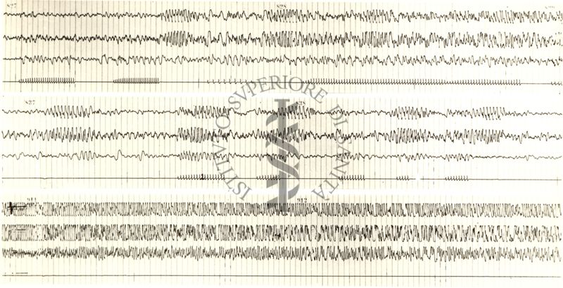 Tracciati elettroencefalografici di coniglio