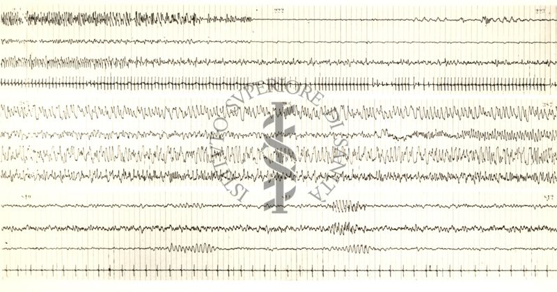 Tracciati elettroencefalografici di coniglio