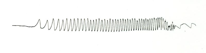 Tracciato elettronistagmografico di coniglio