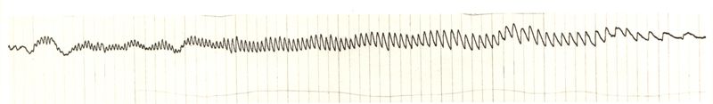 Tracciato dell'elettronistagmografico di coniglio