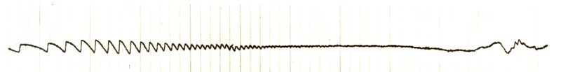 Tracciato dell'elettronistagmografico di coniglio