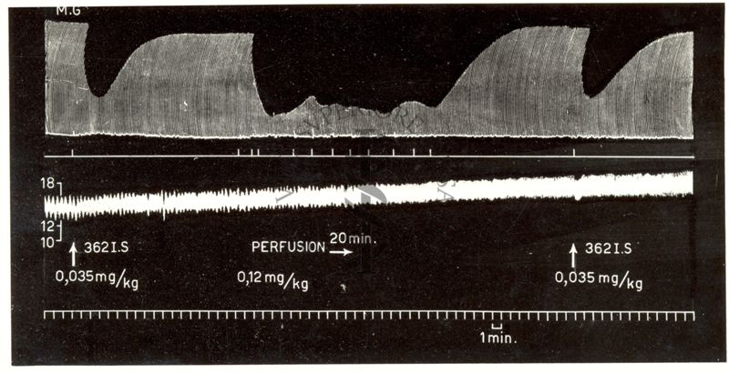 Grafici rappresentanti curari di sintesi (succinilcolina nella perfusione continua nel cane)