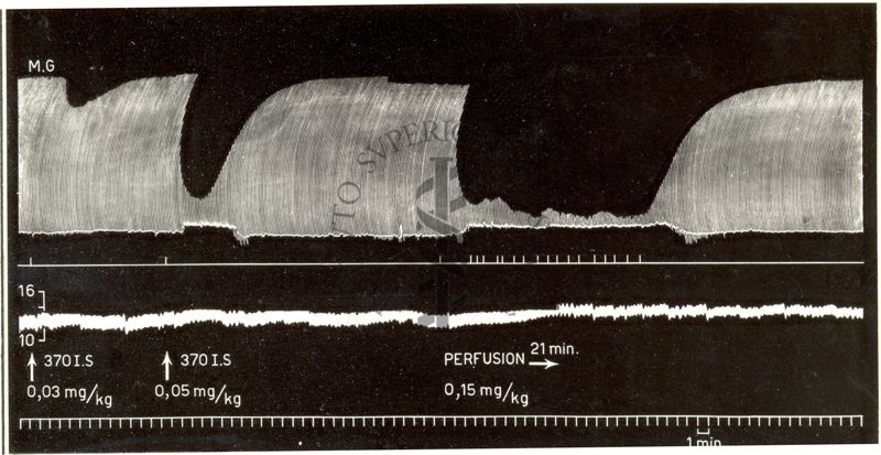 Grafici rappresentanti curari di sintesi (succinilcolina nella perfusione continua nel cane)