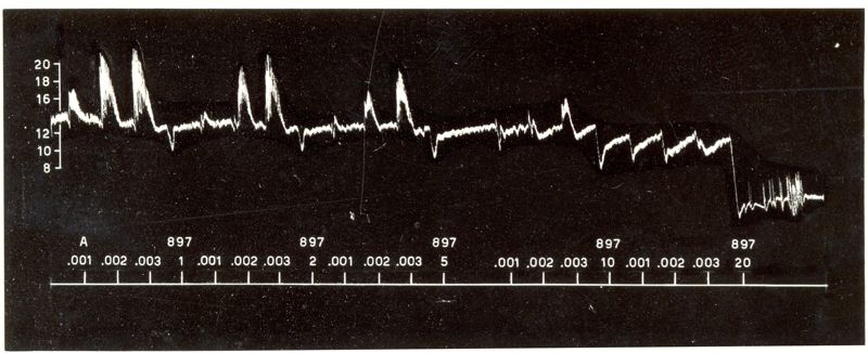 Grafici raffiguranti l'azione sulla pressione arteriosa del cane da simpatolitici di sintesi (derivati dell'ergotammina)