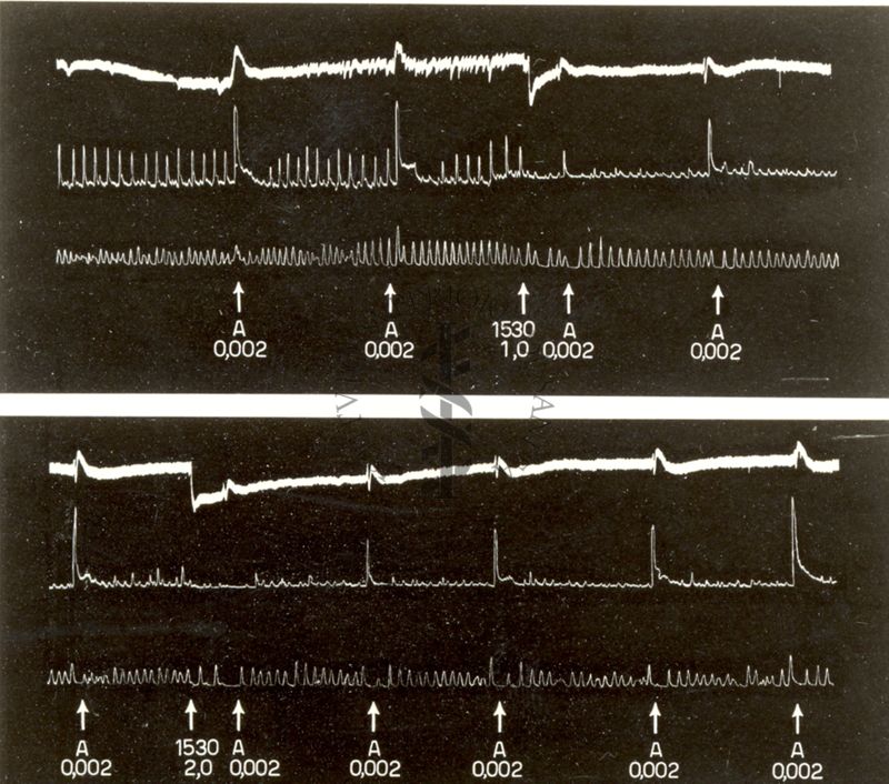 Tabelle e grafici riguardanti l'azione spasmotica del 1205 I.S. e del 1530 I.S.