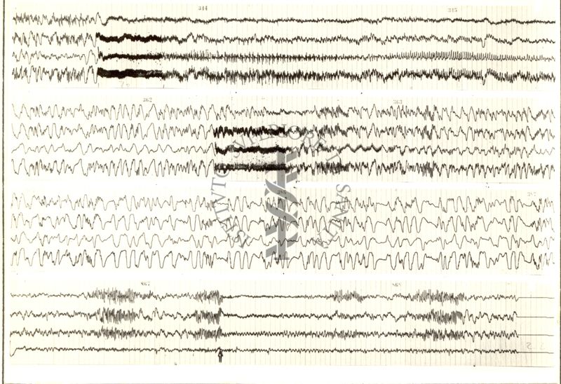 Tracciati elettroencefalografici di coniglio